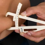 Operația bariatrică este doar începutul. Greșeala care poate duce la recâștigarea kilogramelor pierdute