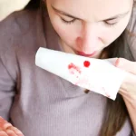 Îți curge mai des sânge din nas când se schimbă vremea? Ce se întâmplă, de fapt, cu mucoasa nazală